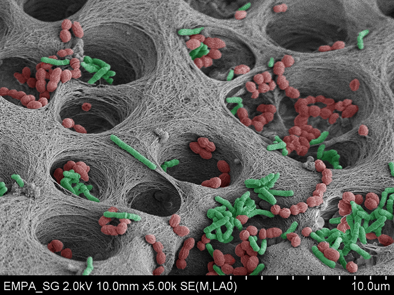 multispecies biofilm on tooth zoom