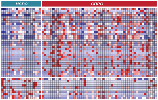 Heat map representing differentially abundant bacterial species between hormone sensitive and castration resistant prostate cancer